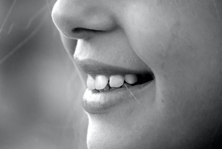 Le fasi del trattamento ortodontico: se ho già messo l'apparecchio perché lo devo rimettere?